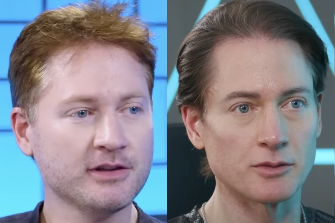 Ngoai hinh cua trieu phu U50 chi 2 trieu USD/nam de tro lai tuoi 18 hinh anh