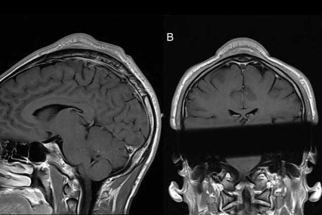 Dau cua vu cong bien dang vi nhung cu xoay, ke dau hinh anh