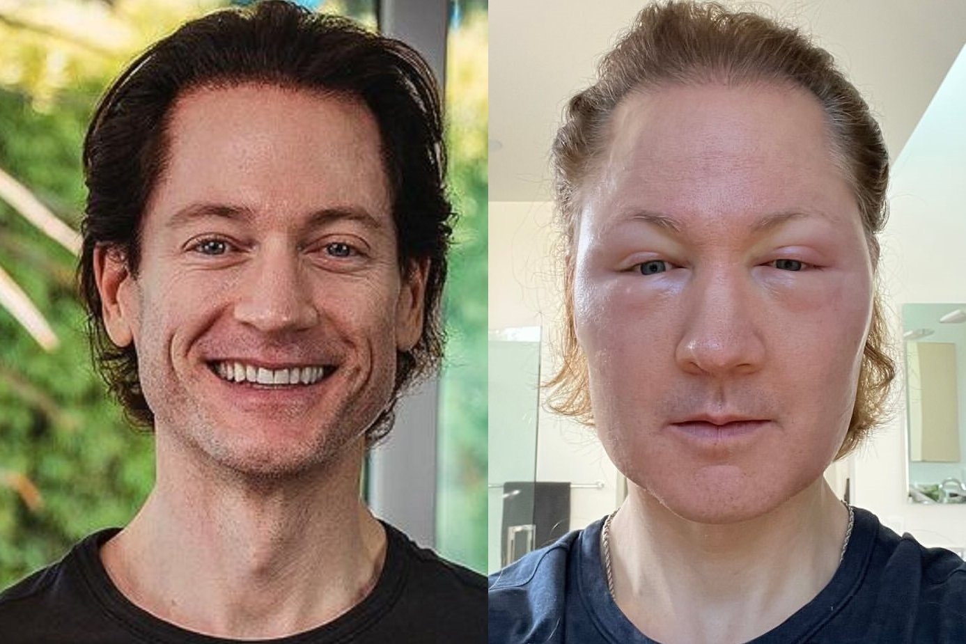 Khuon mat bien dang sau hanh trinh tro lai tuoi 18 cua trieu phu U50 hinh anh