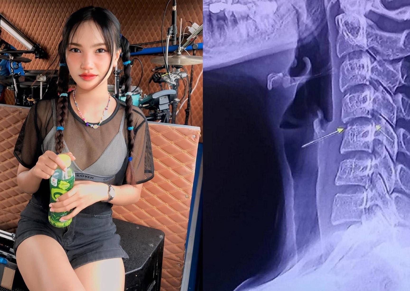 Cu soc doi voi nganh massage Thai Lan hinh anh