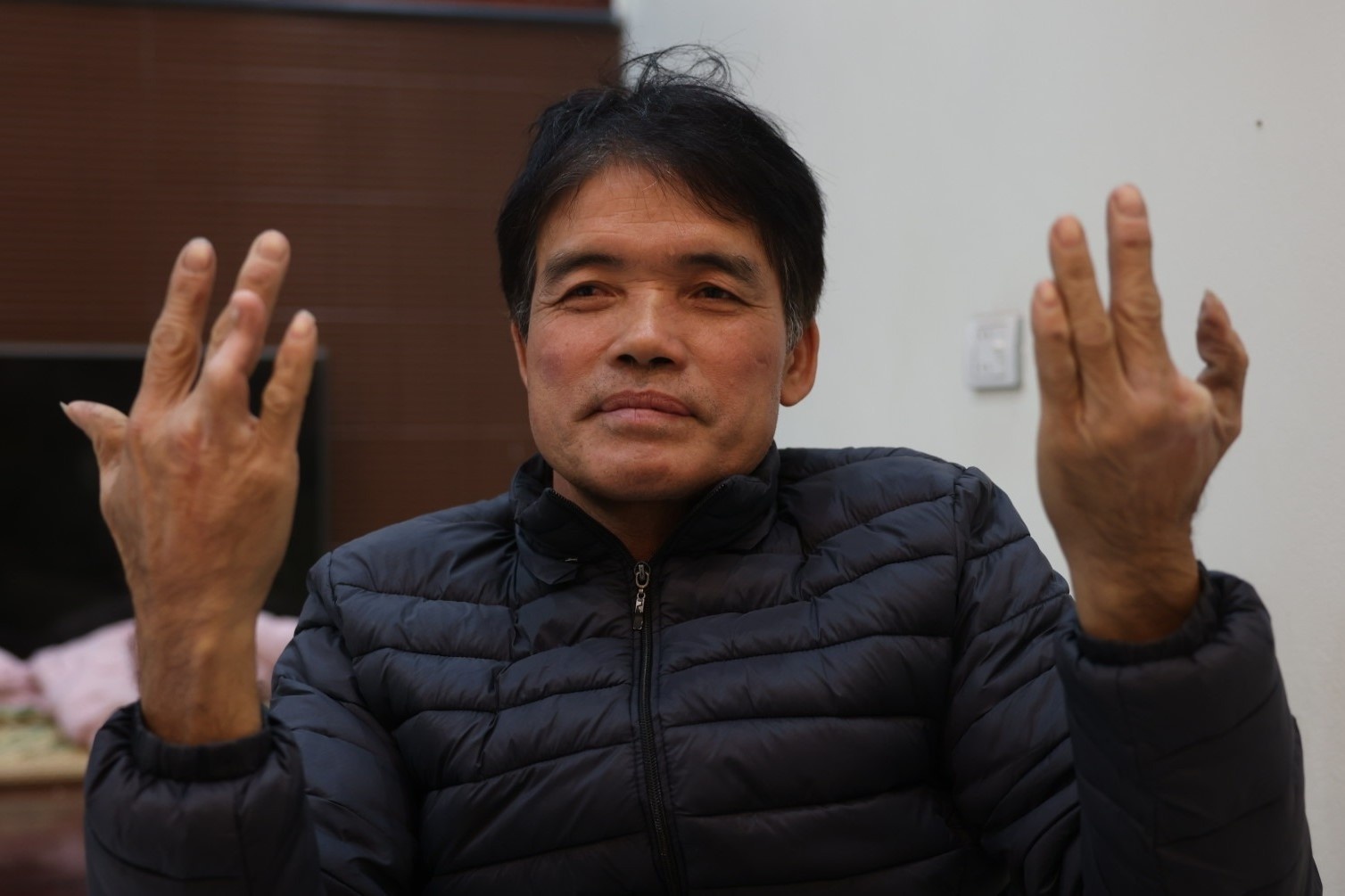 Ban tay thieu ngon 'he lo' su that ron nguoi o lang nuoi ran ho mang hinh anh