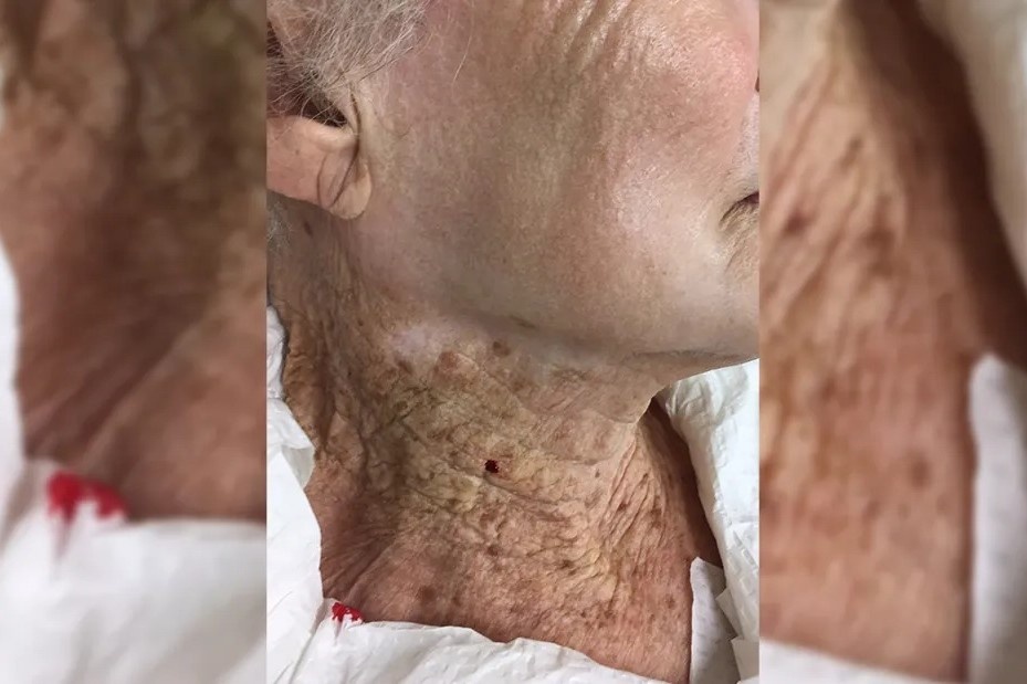 Dieu gi xay ra neu ban khong boi kem chong nang cho co? hinh anh