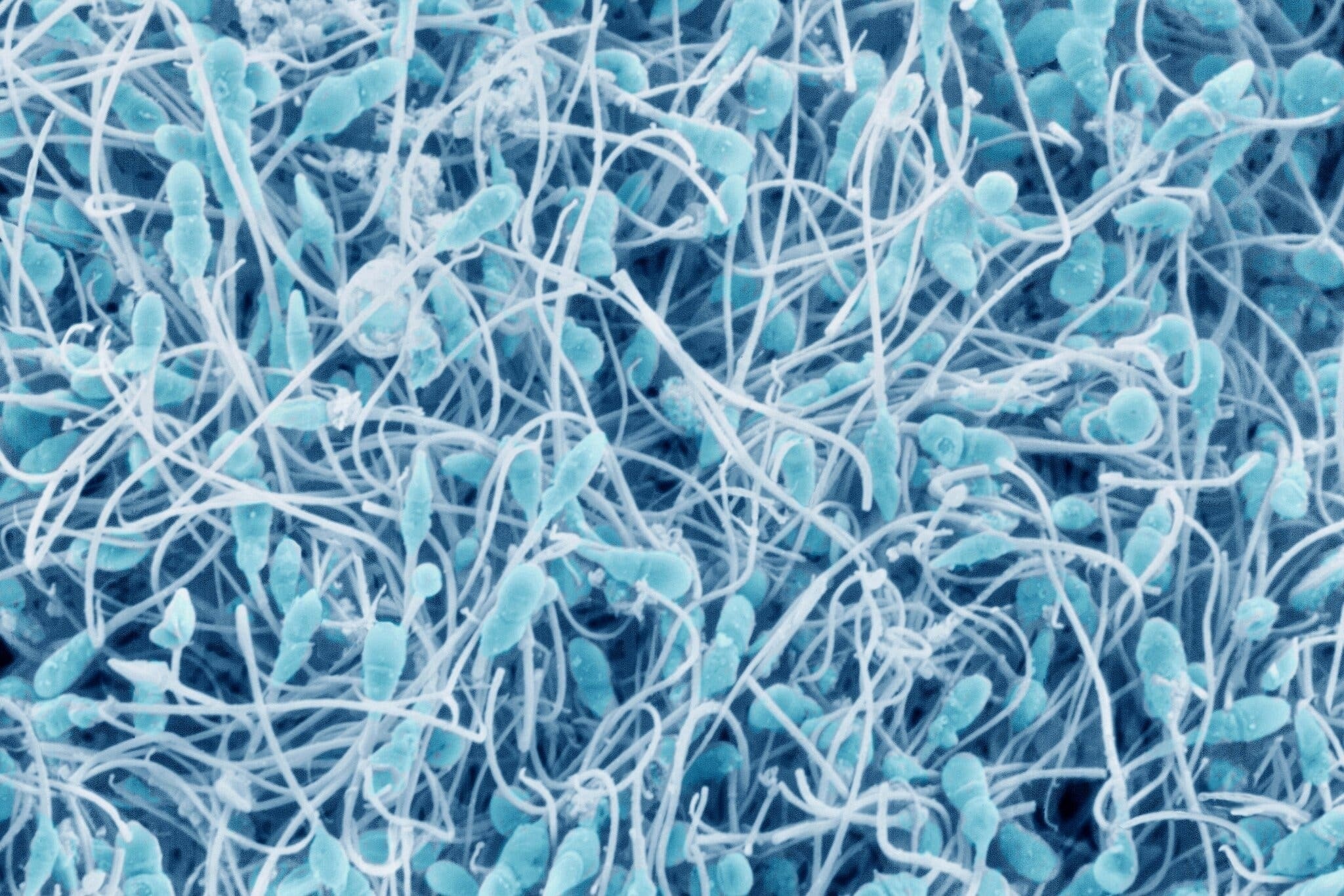 Be boi nguoi hien tinh trung co 67 con, 10 be mac ung thu hiem gap hinh anh