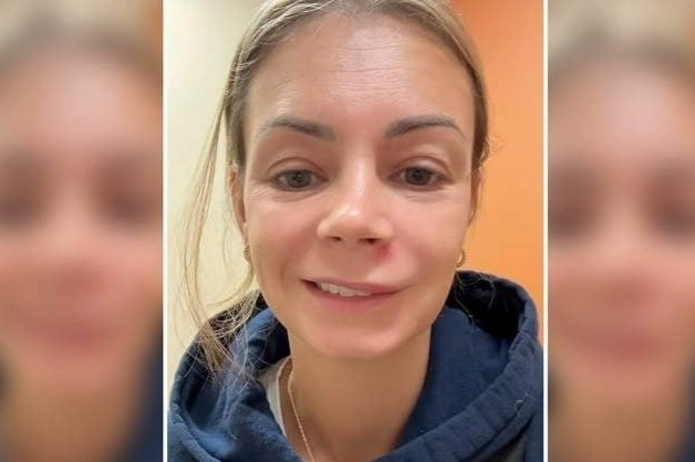 Nan mun o 'tam giac tu than', ba me tre phai nhap vien khan cap hinh anh