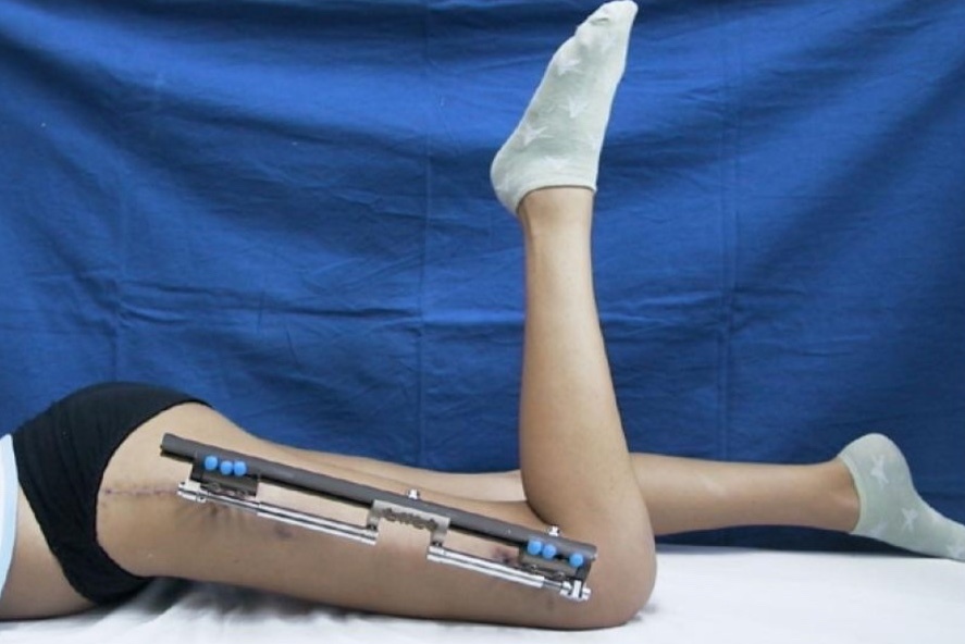 'Cua chan' de duoc thap di hinh anh