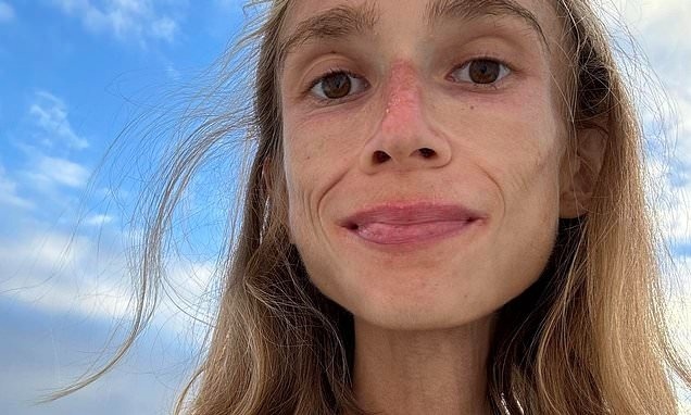 Co gai chet kho trong khach san Bali vi 'chi an trai cay' hinh anh