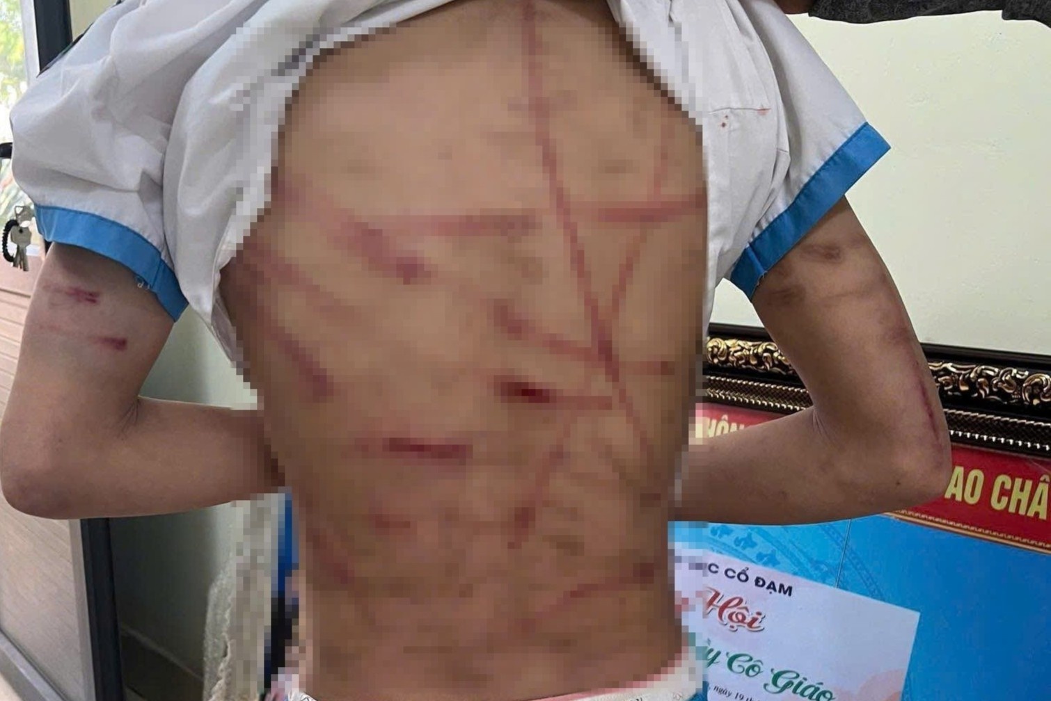 Cong an vao cuoc vu be gai nghi bi cha duong bao hanh o Ha Tinh hinh anh