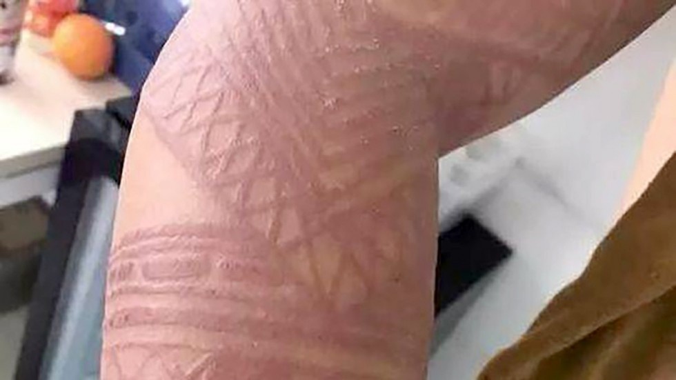 Du khach Bali canh cao henna tattoo gia co the gay hai suc khoe hinh anh