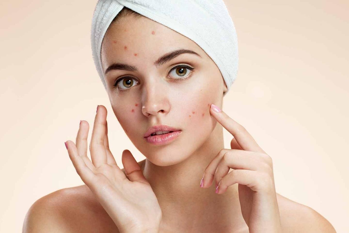 7 vi tri noi mun tren mat canh bao ve tinh trang suc khoe hinh anh