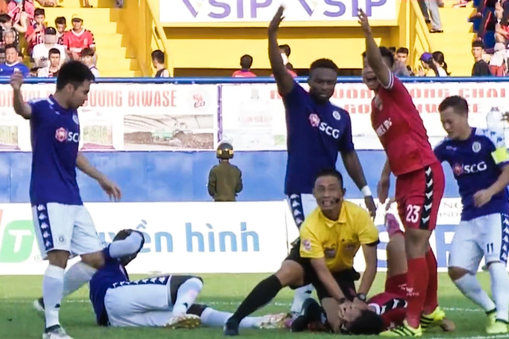 Cach so cuu chung nuot luoi thuong gap trong bong da hinh anh