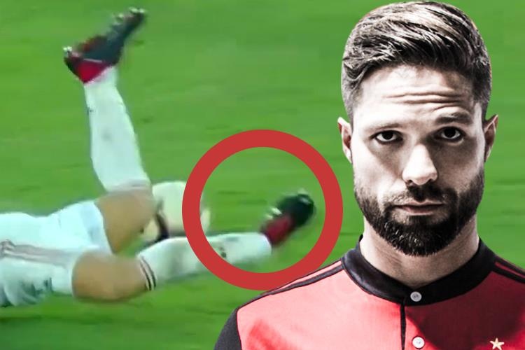 Can canh pha gay gap co chan cua cuu cau thu Juventus hinh anh