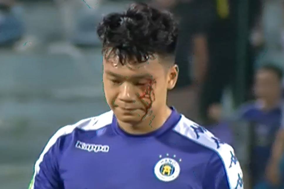 Thanh Chung chay mau sau va cham voi Phi Son hinh anh