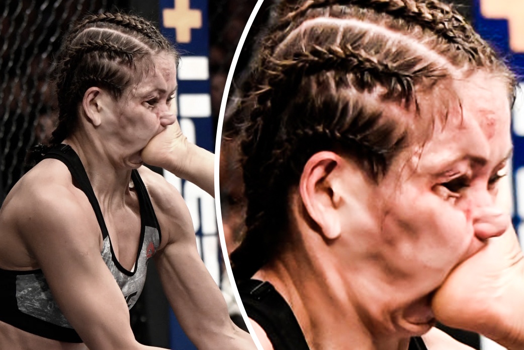 Nu vo si Ba Lan bi ton thuong mat sau cu da cua doi thu hinh anh