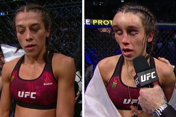 Guong mat bien dang cua nu vo si sau tran dau hinh anh