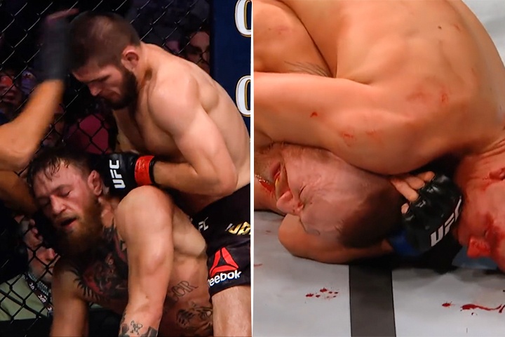 McGregor va ac mong bi khoa co tren san MMA hinh anh