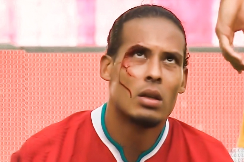 Van Dijk roi san vi do mau sau pha va cham hinh anh