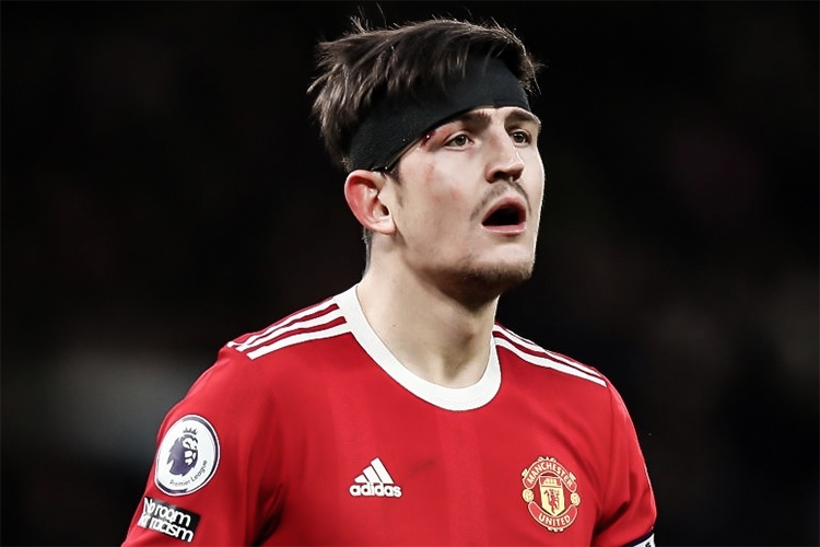 Maguire: 'MU that vong voi kha nang phong ngu' hinh anh