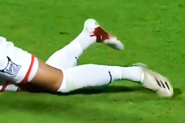 Co chan dam mau sau cu vao bong cua dong doi hinh anh