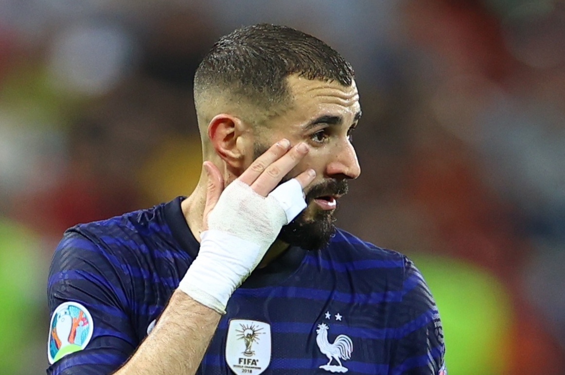 Su tro lai cua Benzema khien tuyen Phap phai tra gia hinh anh