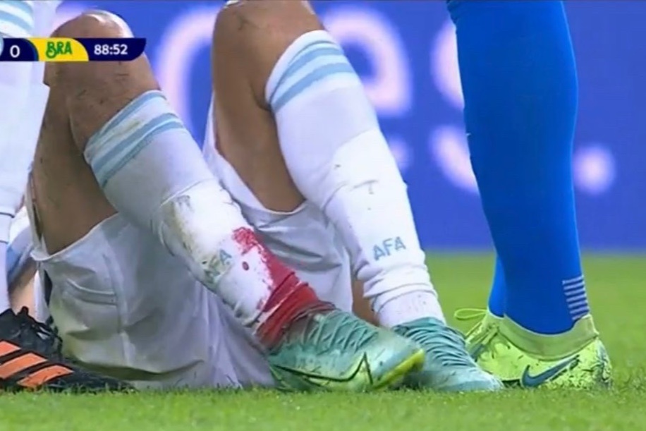 Chan rom mau cua sao Argentina hinh anh