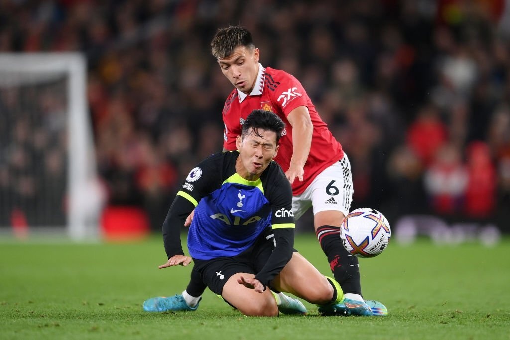 Phan ung cua sao MU anh 1