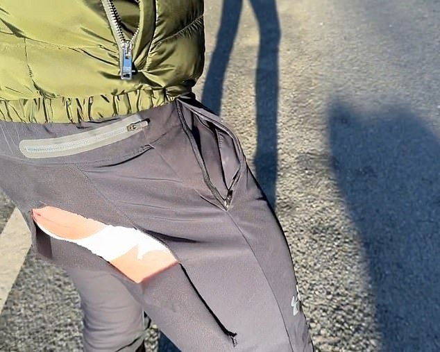 McGregor bi tai nan anh 2