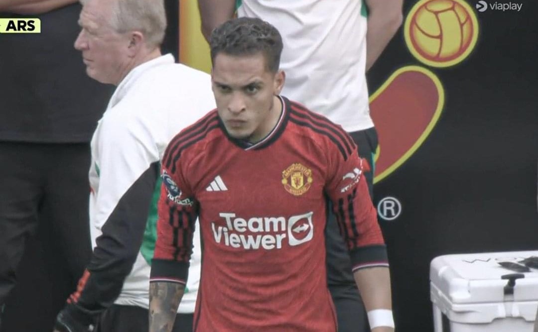 Hinh anh gay cuoi cua Antony hinh anh