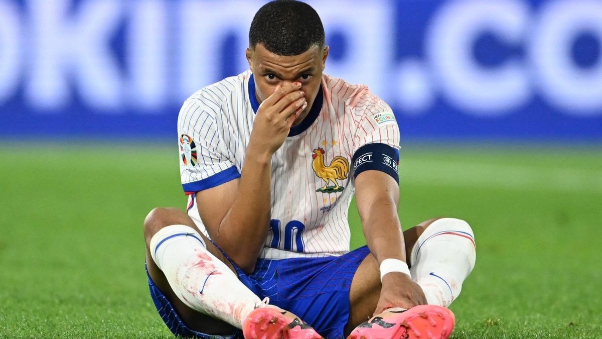 Tinh trang cua Mbappe sau su co vo mui hinh anh