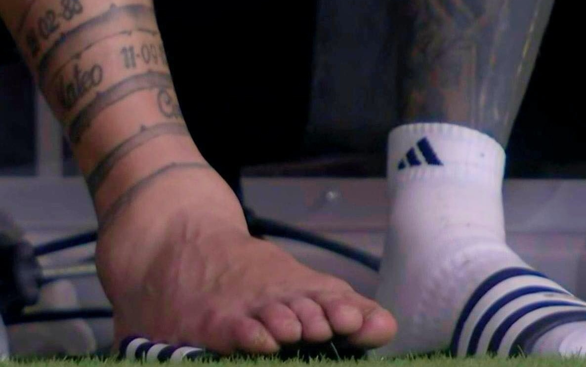 Chan Messi bien dang hinh anh