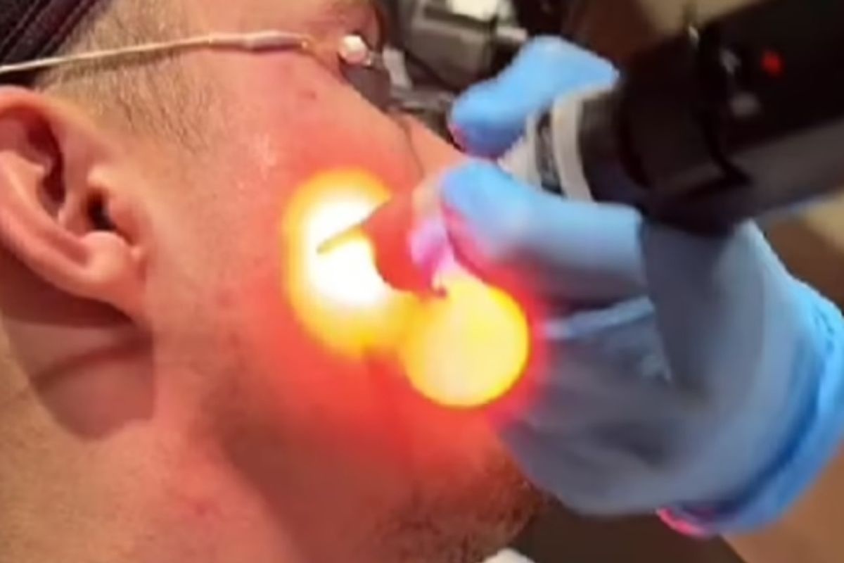 Tien dao MU di tri mun hinh anh