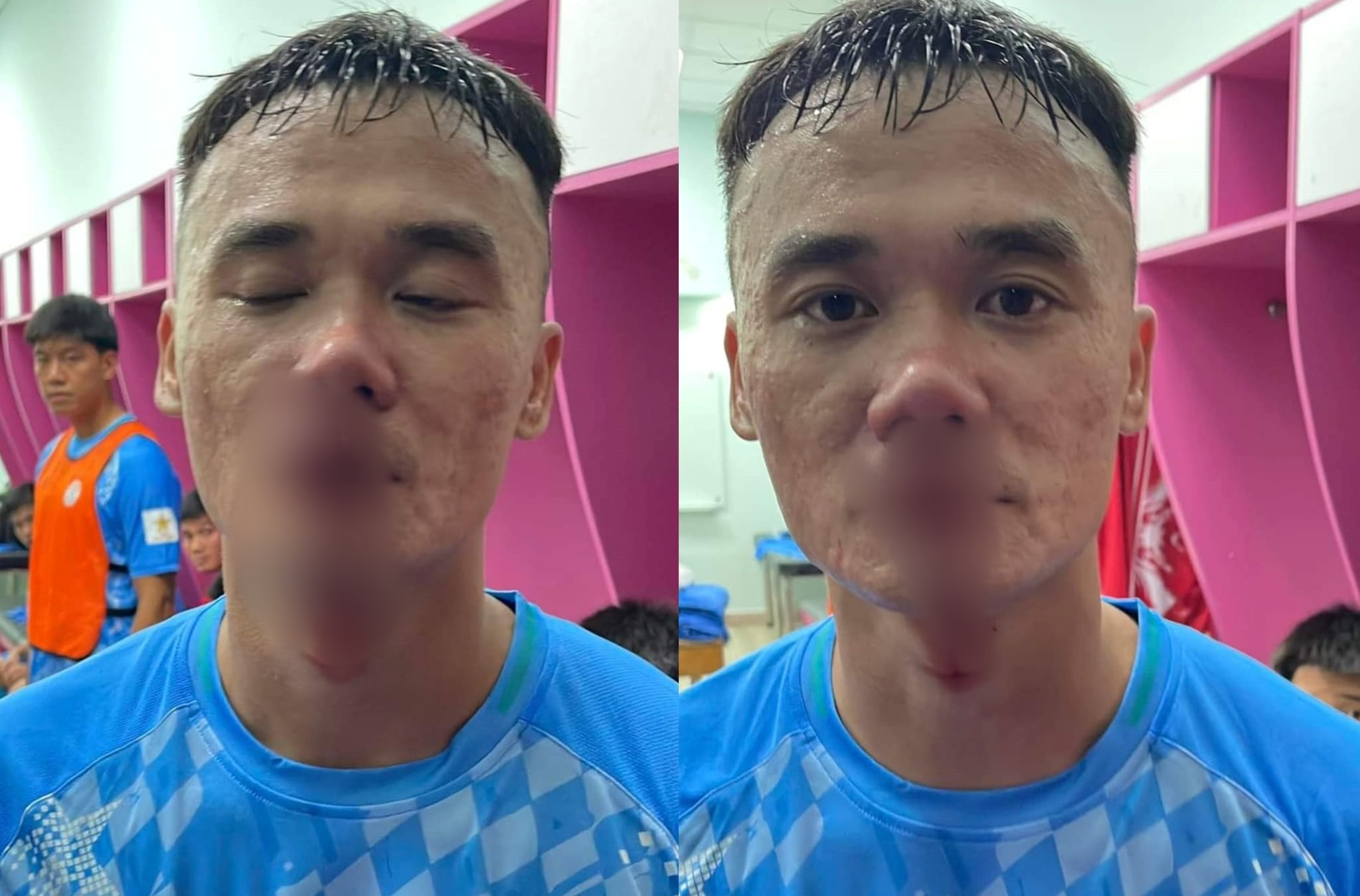 Ro tin cau thu PVF-CAND bi danh chay mau hinh anh