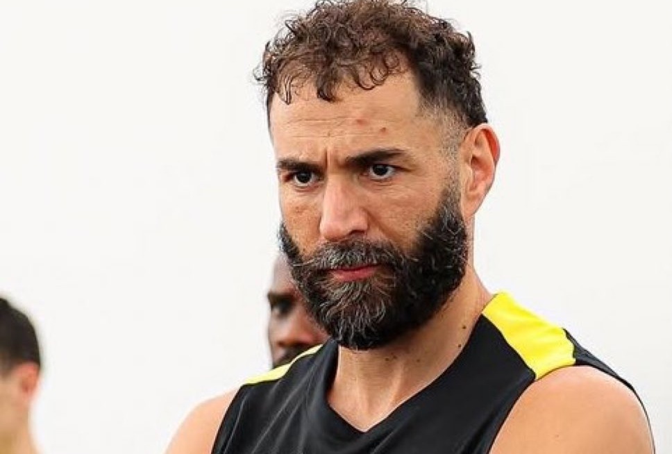 Dien mao khac la cua Benzema hinh anh