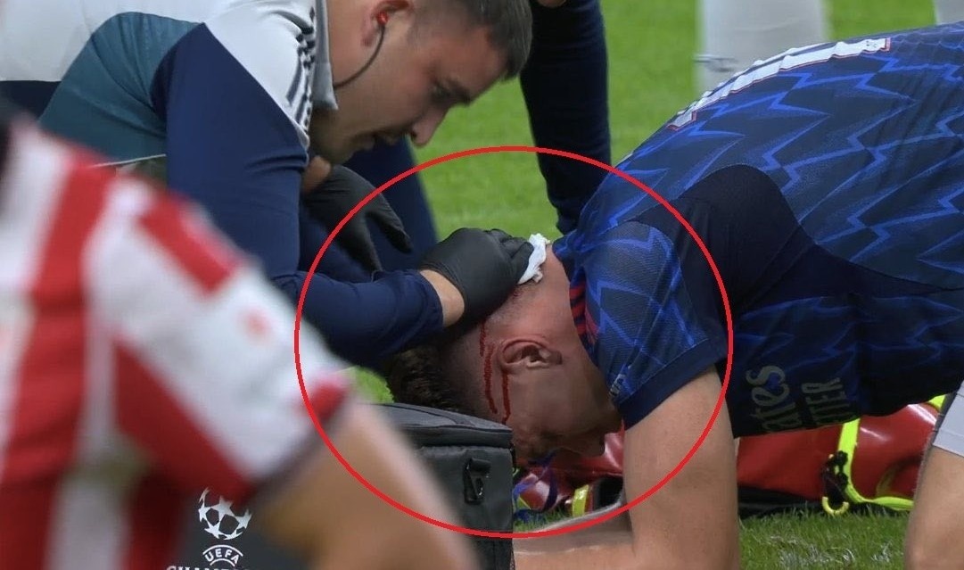 Gyokeres do mau hinh anh