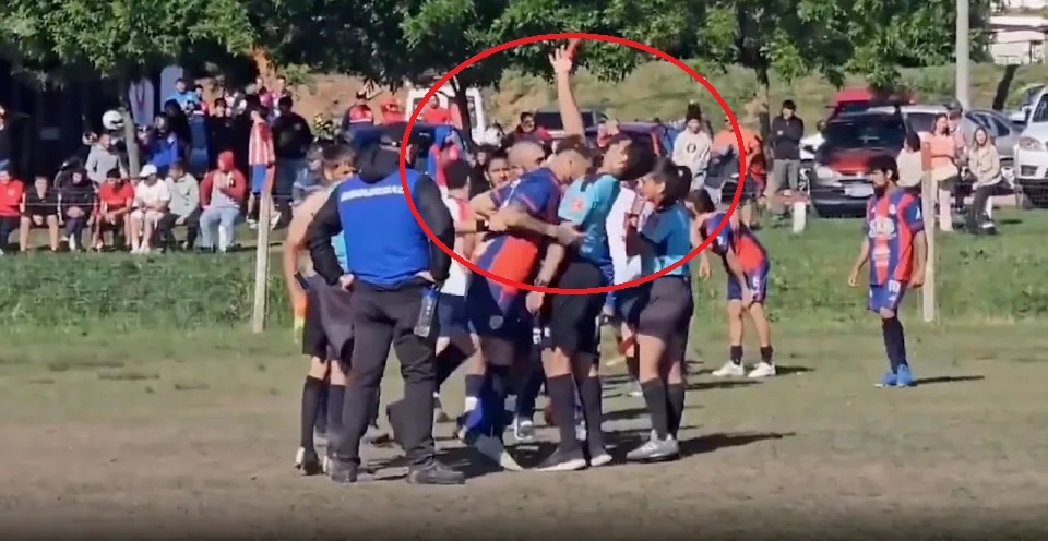 Cu huc dau gay chan dong bong da Uruguay hinh anh