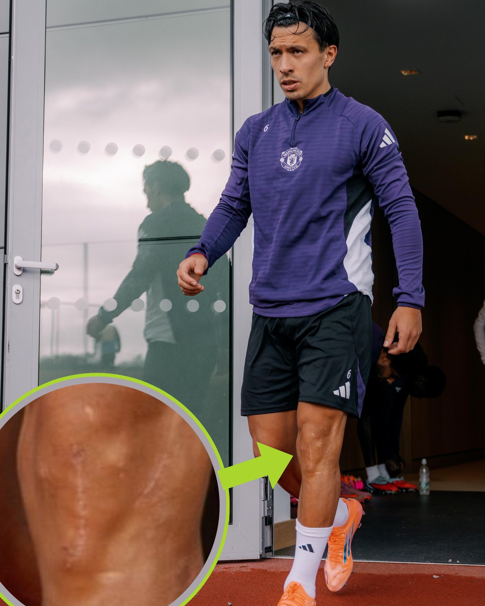 Vet seo dang so anh 1