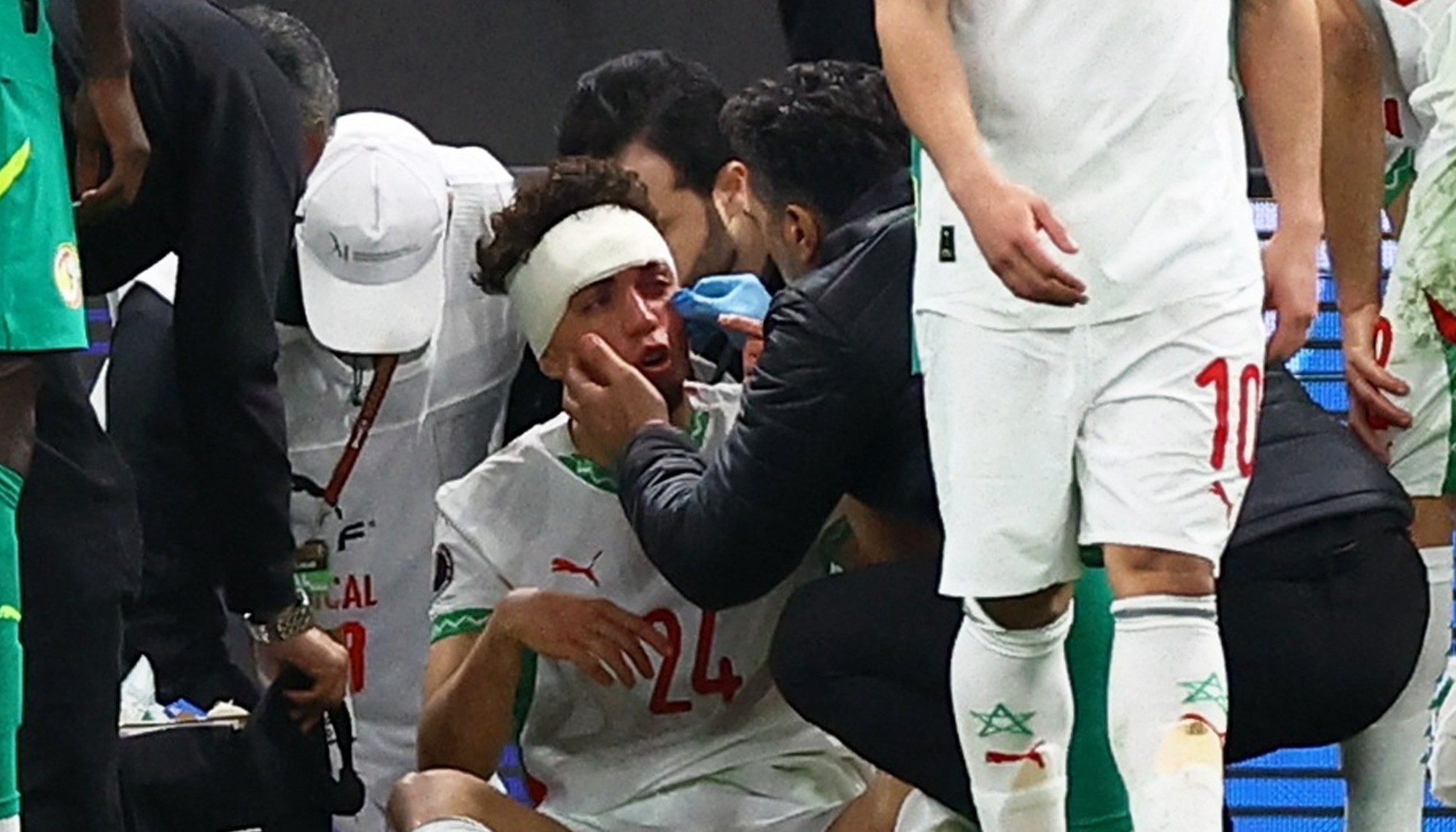 Chan thuong nghiem trong o chung ket cup chau Phi hinh anh