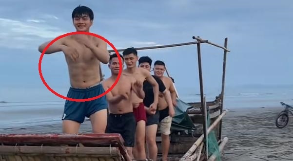 Co bung 6 mui cua Van Binh gay chu y hinh anh