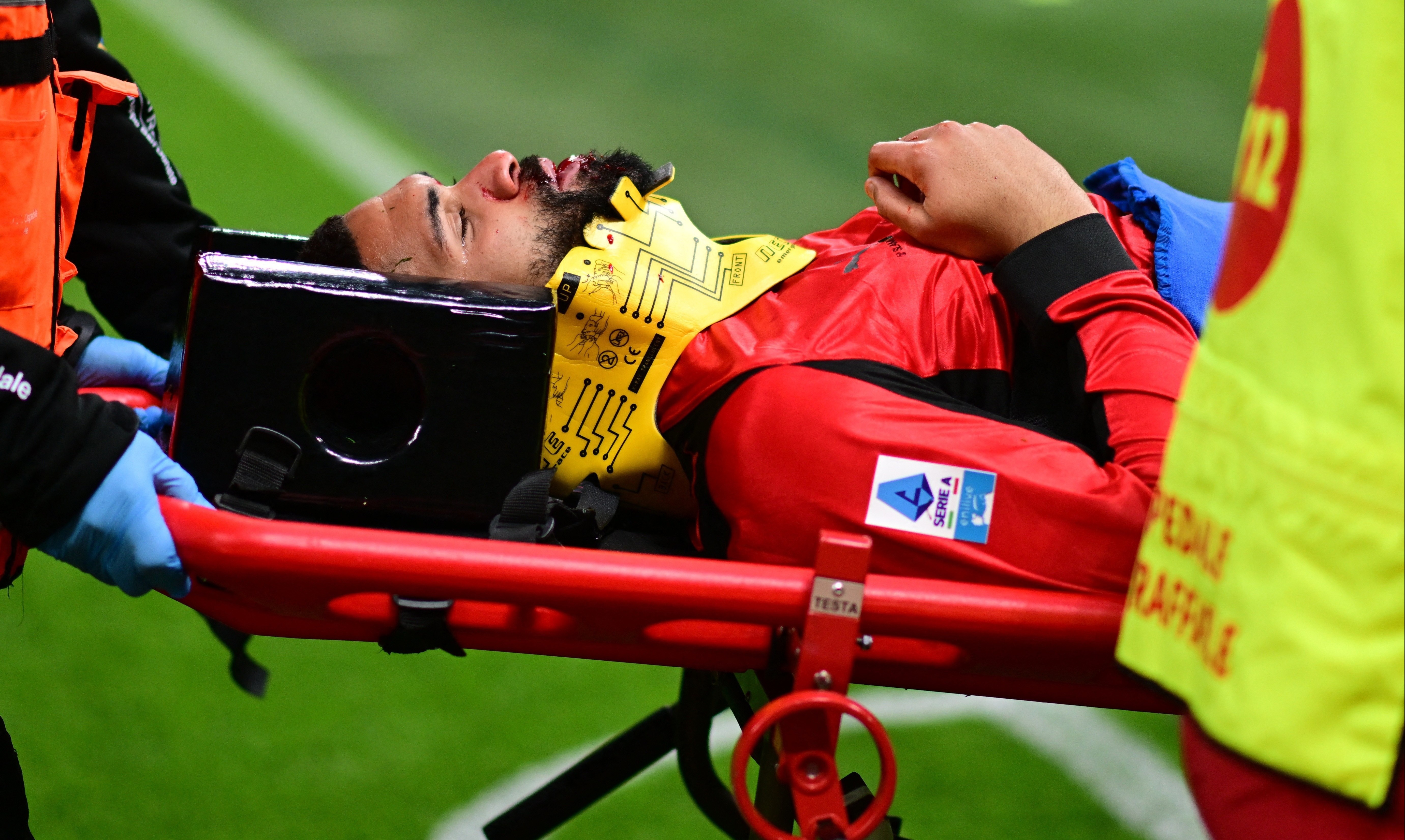 Tuyen thu Anh chan thuong ghe ron hinh anh