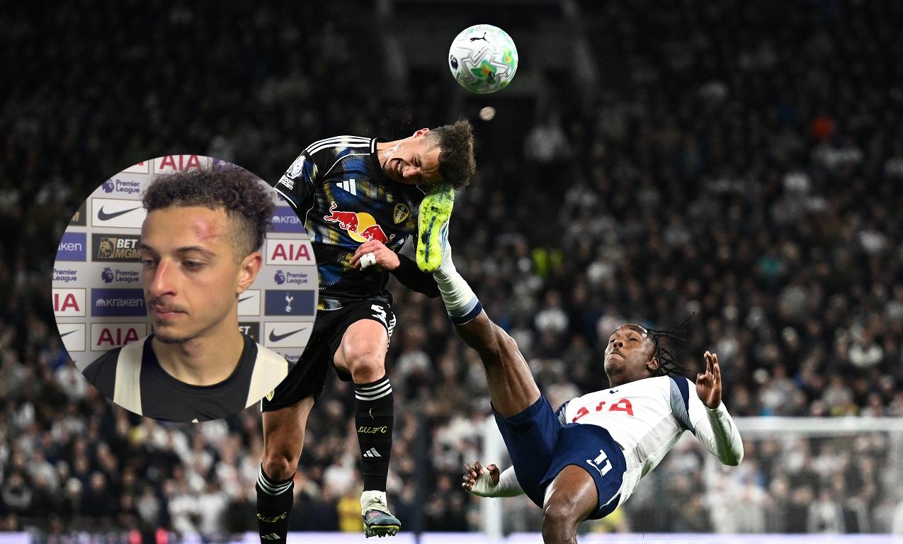 Sai lam ngo ngan cua cau thu Tottenham hinh anh