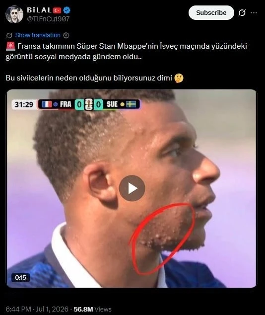 Mbappe anh 1