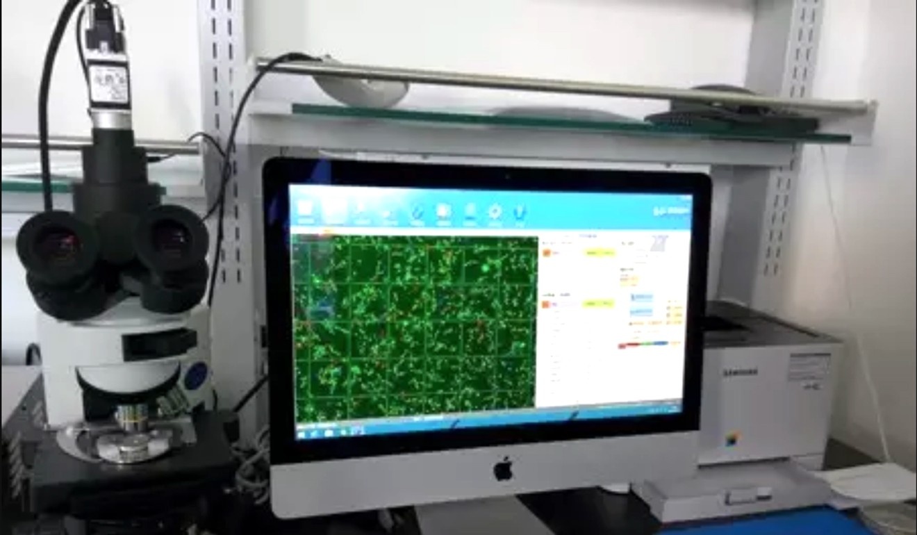 hiến tinh trùng ảnh 1 hien tinh trung anh 1