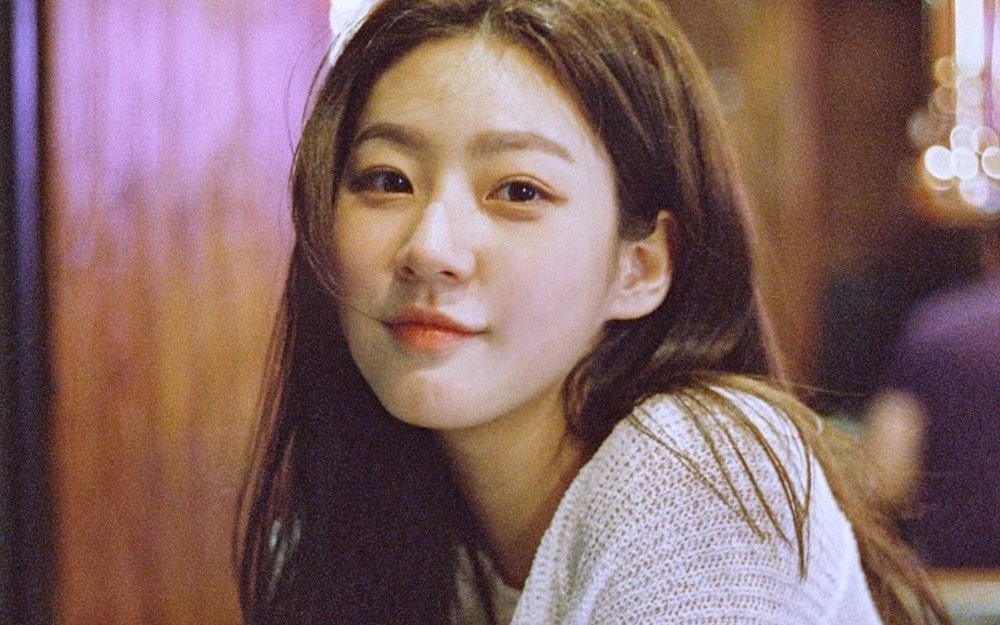 Kim Sae Ron phai boi thuong sau vu tai nan hinh anh