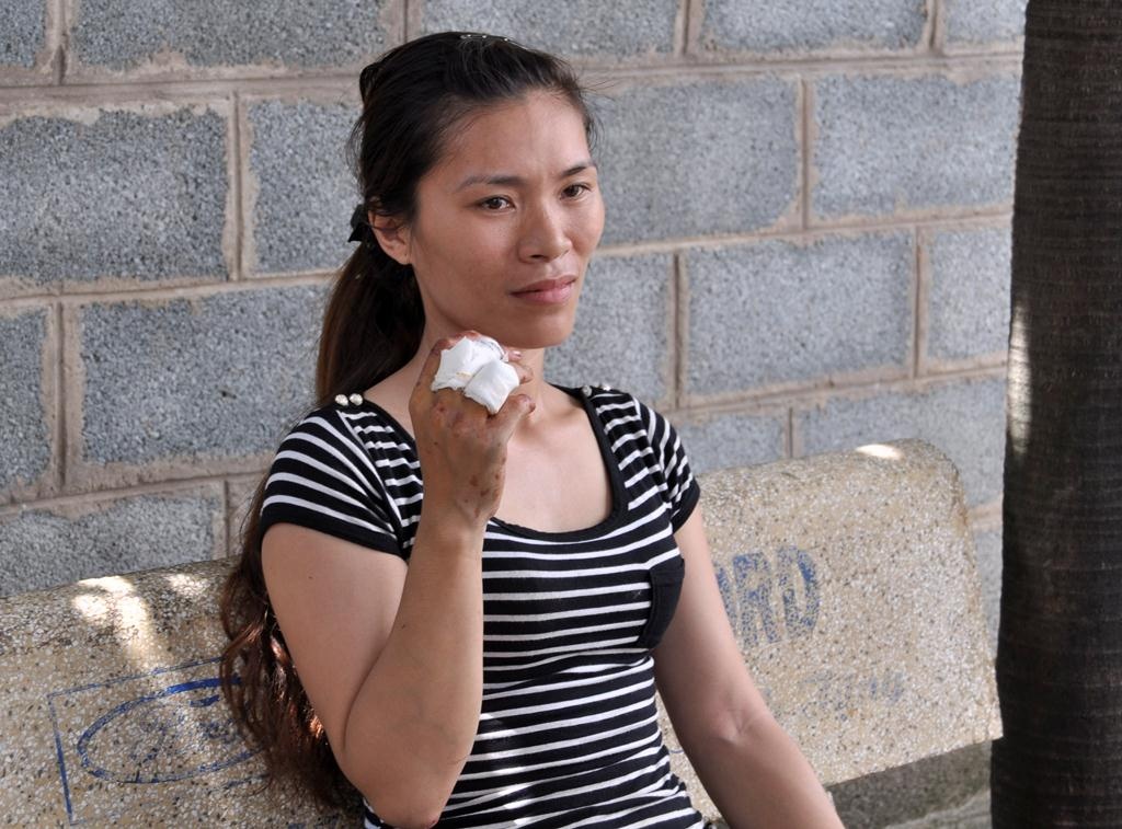 Nguyễn Thị Nhung bị thương ở tay. Ảnh: Ngọc An