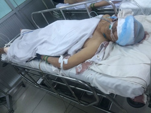 Tu vong vi loa phat thanh cua benh vien roi trung dau hinh anh