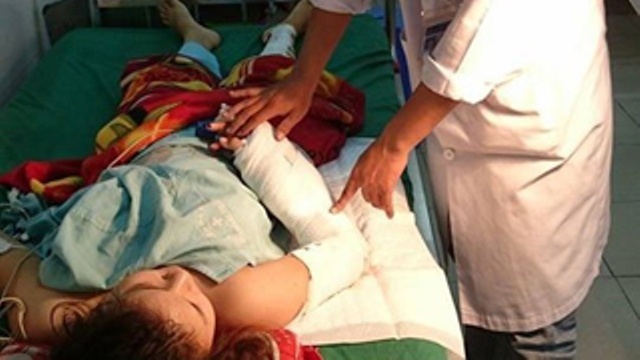 Nu cong nhan bi may danh bong go cuon nat canh tay hinh anh