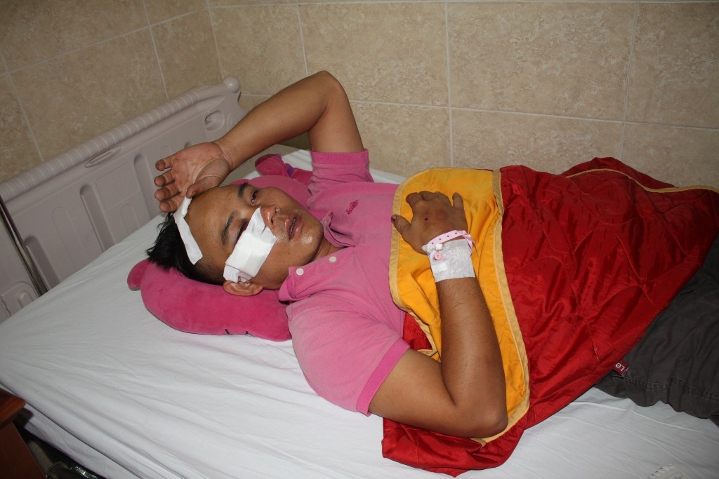 Bat nghi can dung bua dap dau tai xe trong oto hinh anh