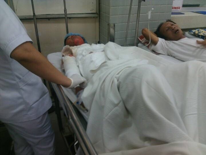 chong thieu vo anh 1