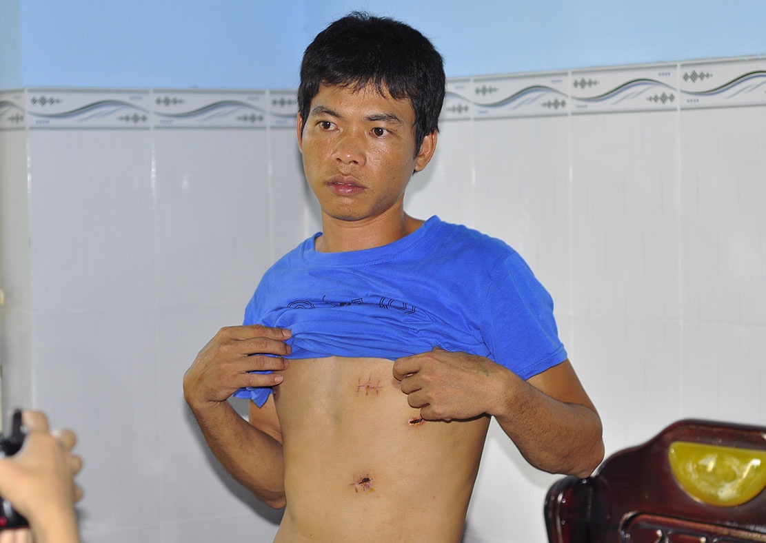 cong an no sung anh 1