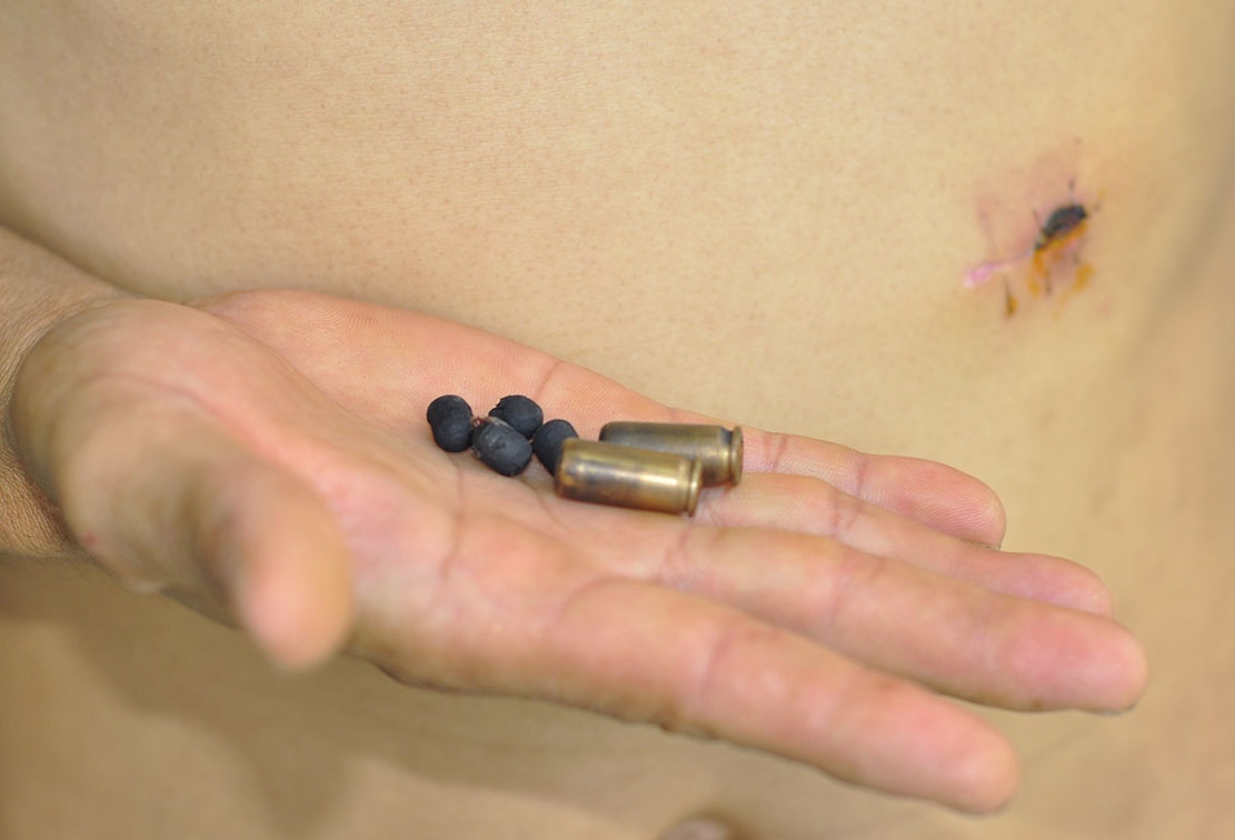 Nam thanh nien cam dao linh 4 phat dan cua cong an hinh anh