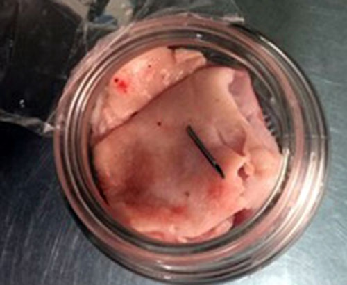 Phat hien kim tiem trong thit heo o Da Lat hinh anh